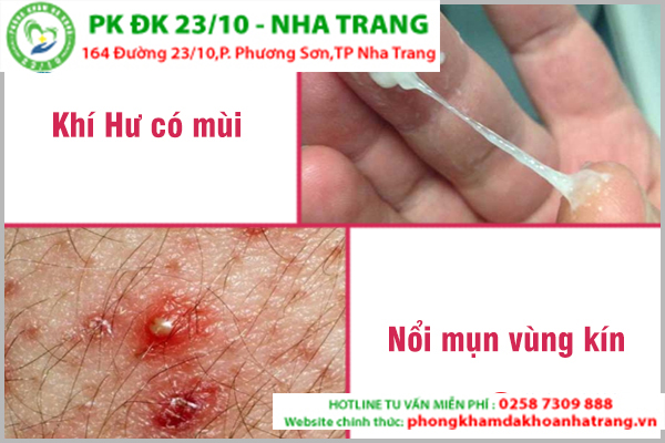 Ngứa phụ khoa do nguyên nhân nào gây ra?